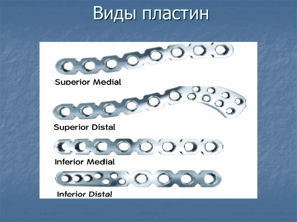 Виды пластин